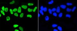 Nrf2, p Ser40 Antibody (SU0334), Novus Biologicals 100&mu;L:Antibodies,